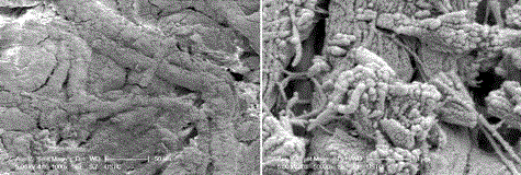 A method for making a guided tissue regeneration membrane with an absorbable antibacterial bone-like structure