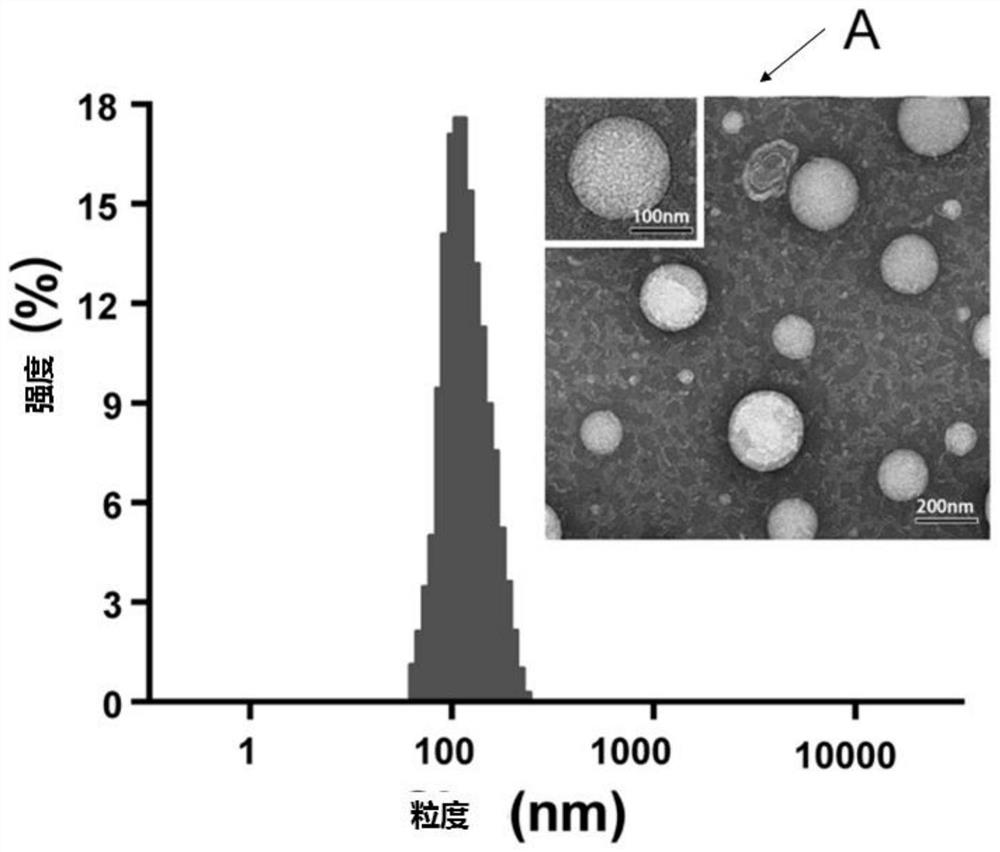 Paclitaxel liposome and preparation method thereof