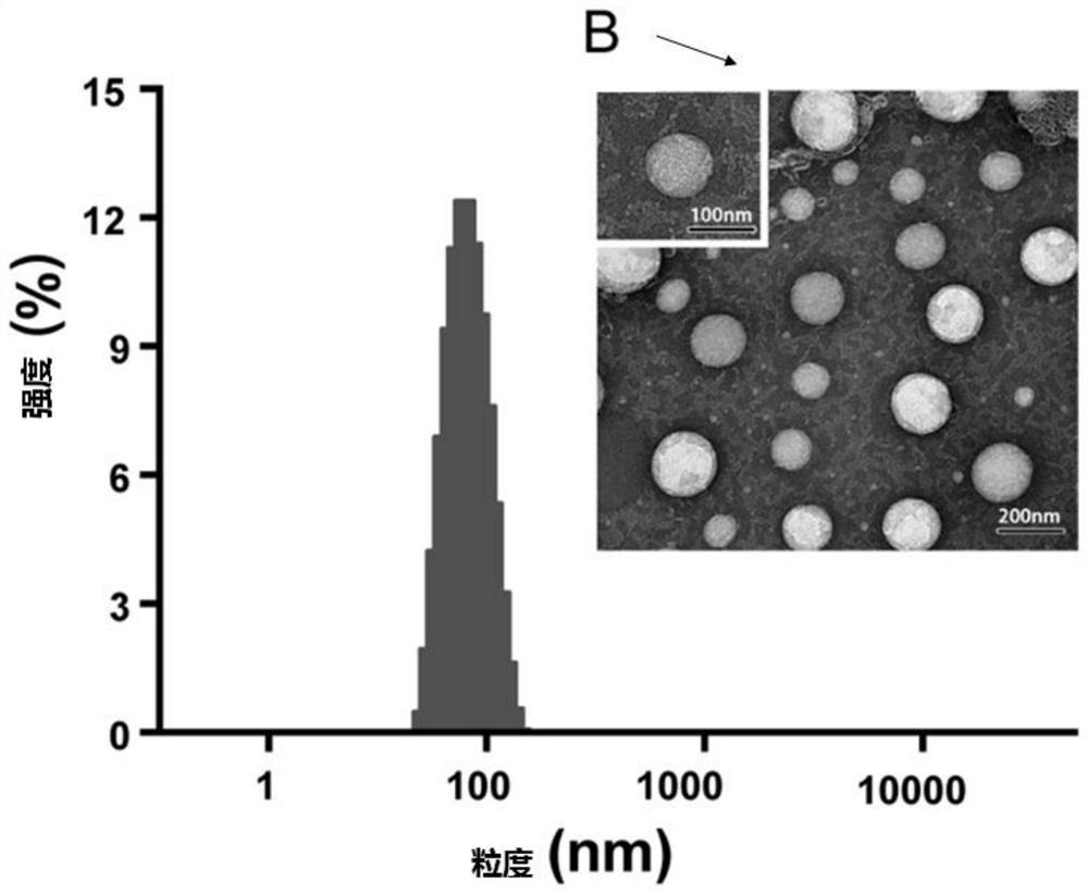 Paclitaxel liposome and preparation method thereof