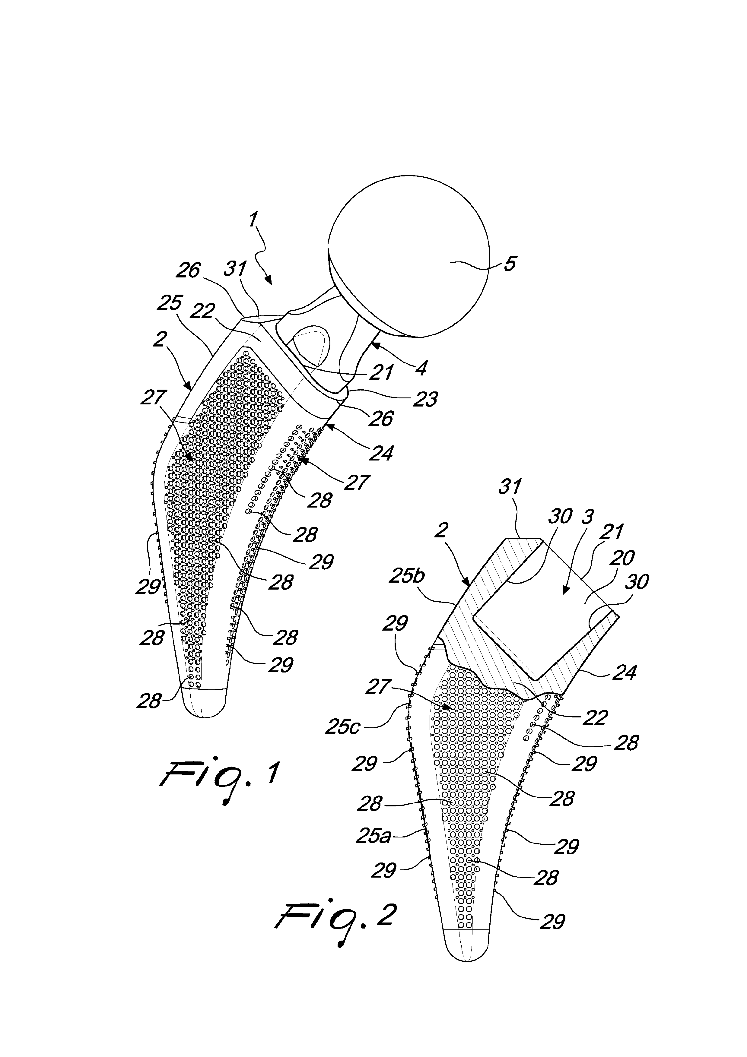 Modular prosthetic device for hip joint replacement