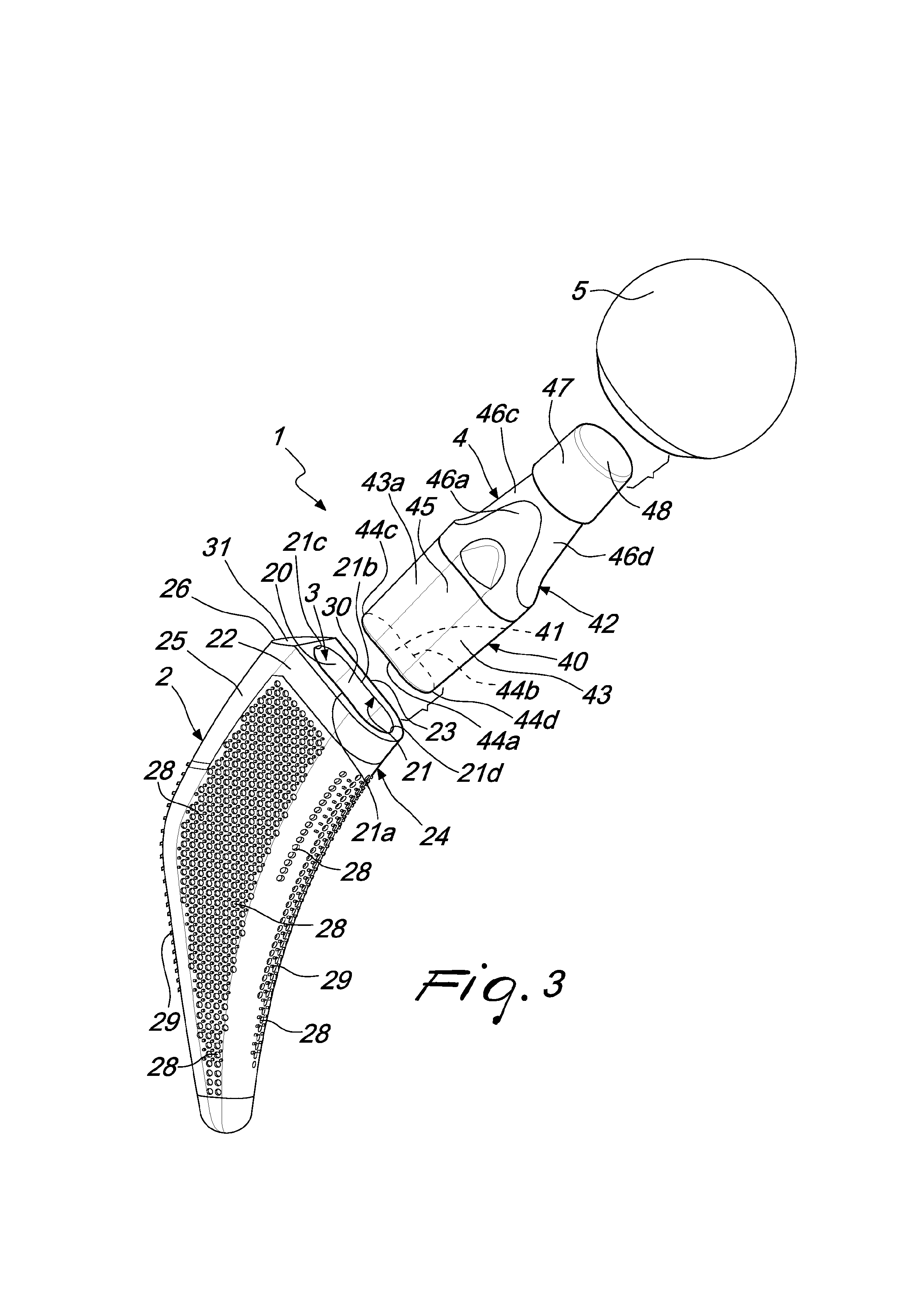 Modular prosthetic device for hip joint replacement