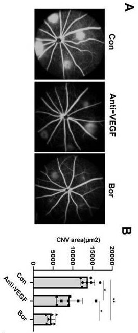 Application of bortezomib and preparation of bortezomib to preparation of medicine for treating choroidal neovascularization related diseases and preparation method of eye drops