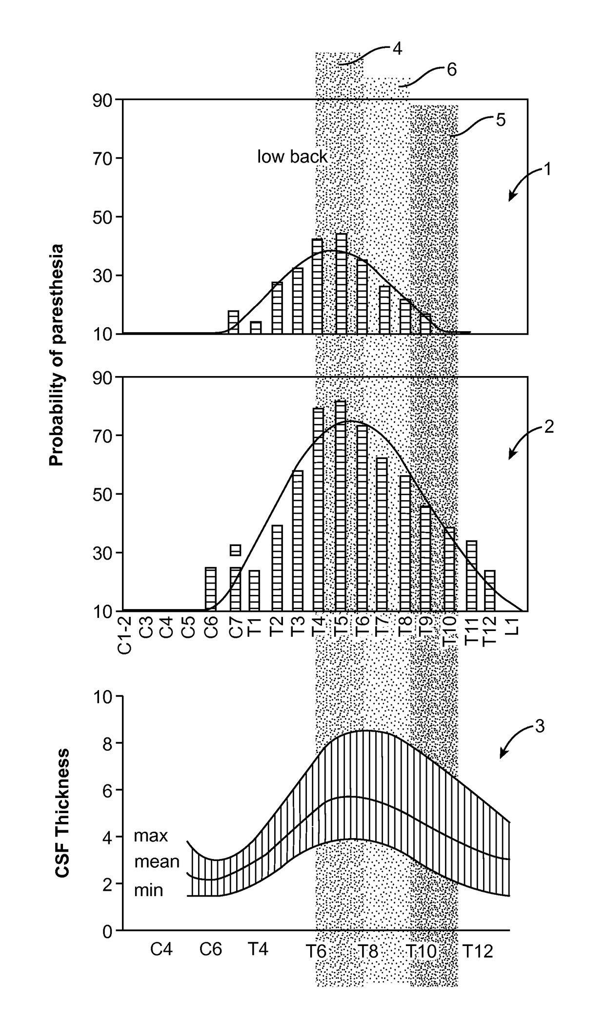 Method for achieving low-back spinal cord stimulation without significant side-effects