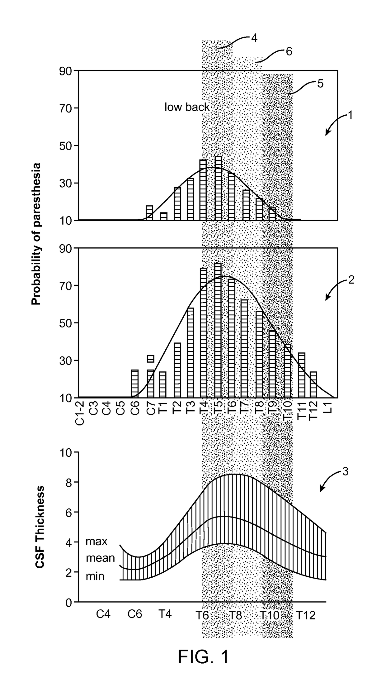 Method for achieving low-back spinal cord stimulation without significant side-effects