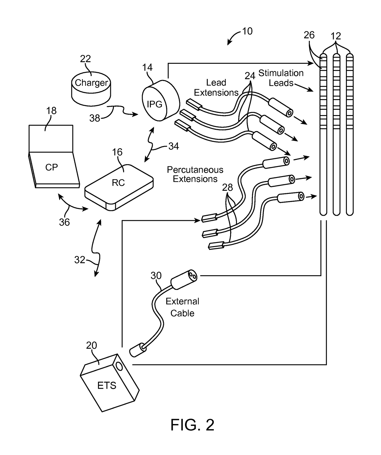 Method for achieving low-back spinal cord stimulation without significant side-effects