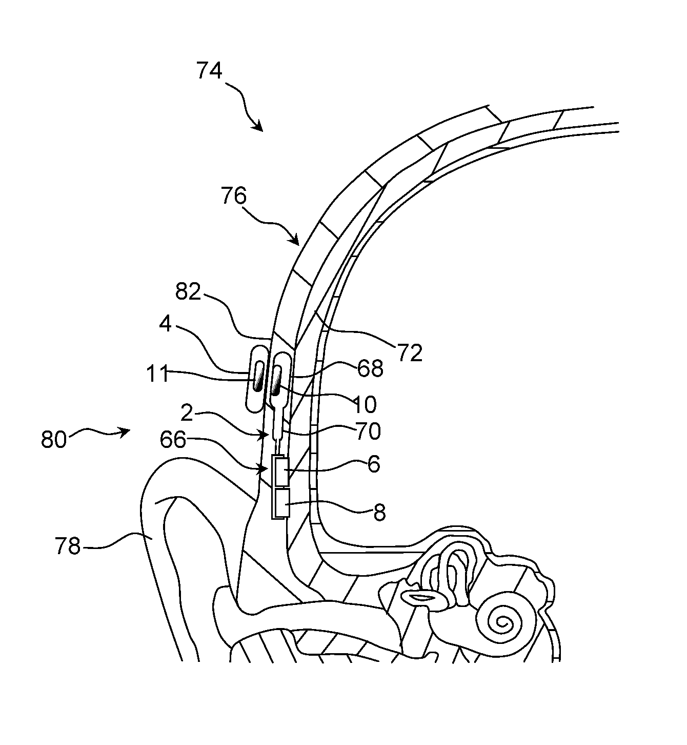 Hearing aid device using dual electromechanical vibrator