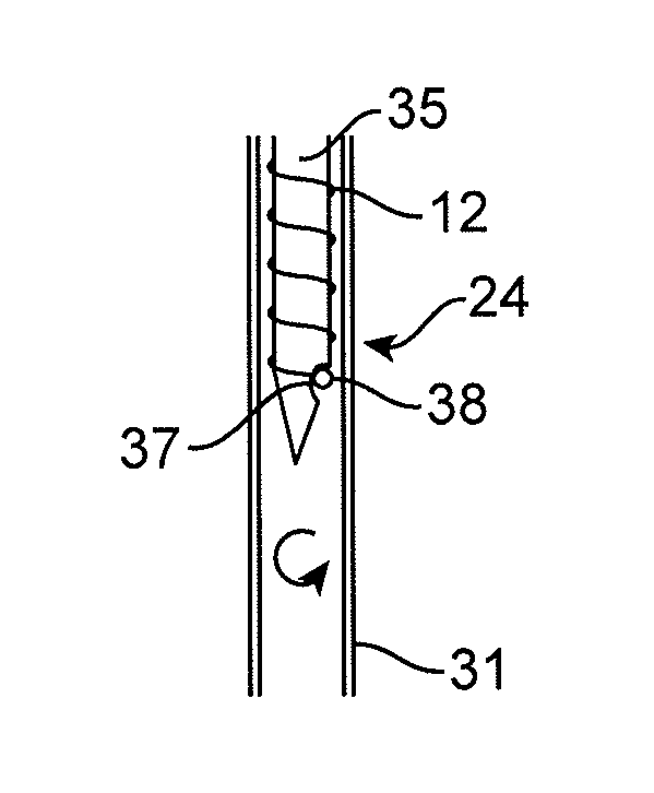 Platform device and method of use to assist in anastomosis formation