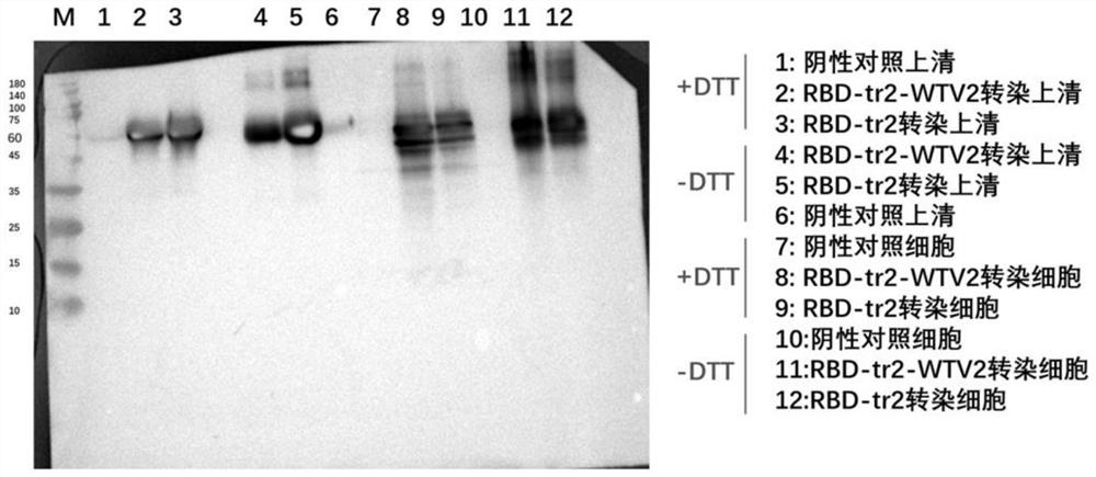 Novel coronavirus multivalent antigen as well as preparation method and application thereof