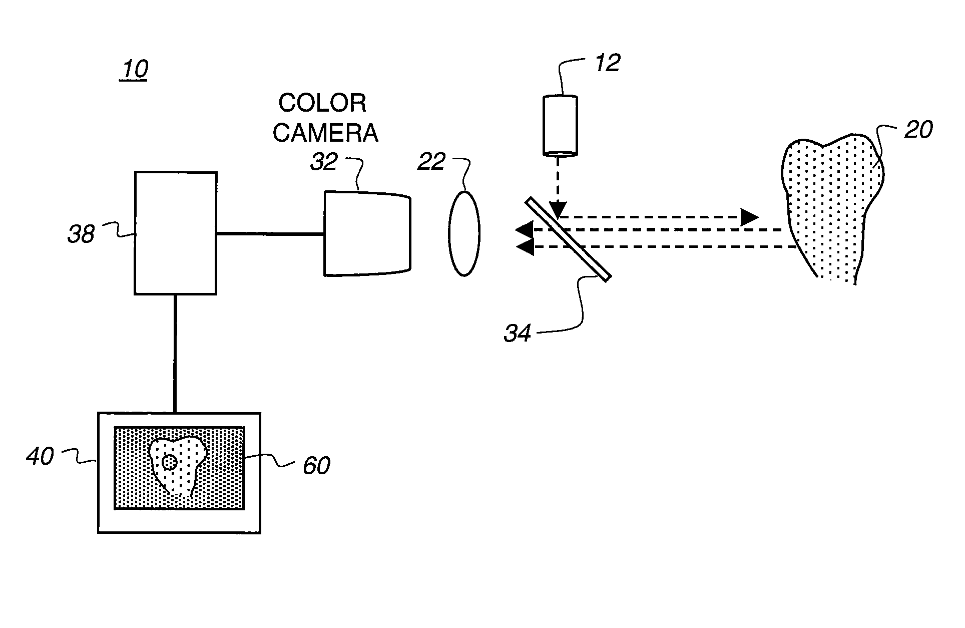 Apparatus for caries detection