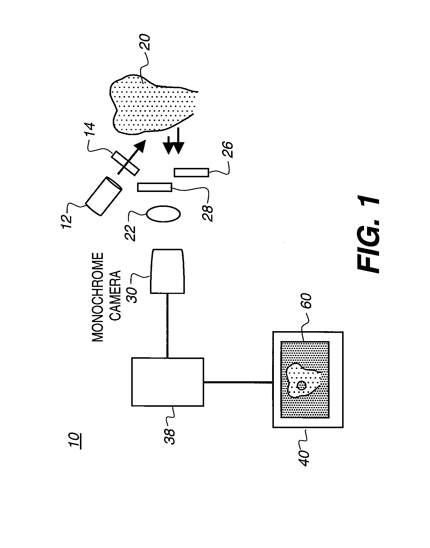 Apparatus for caries detection