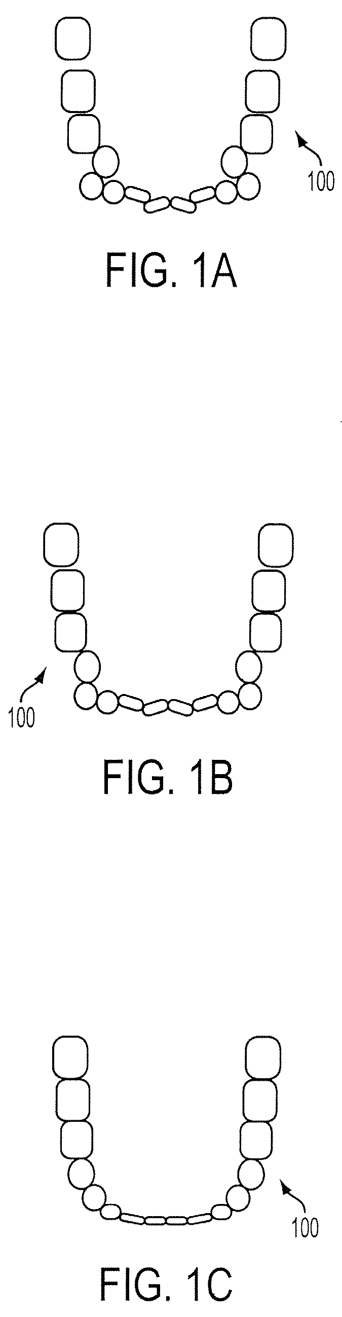 Automated treatment staging for teeth