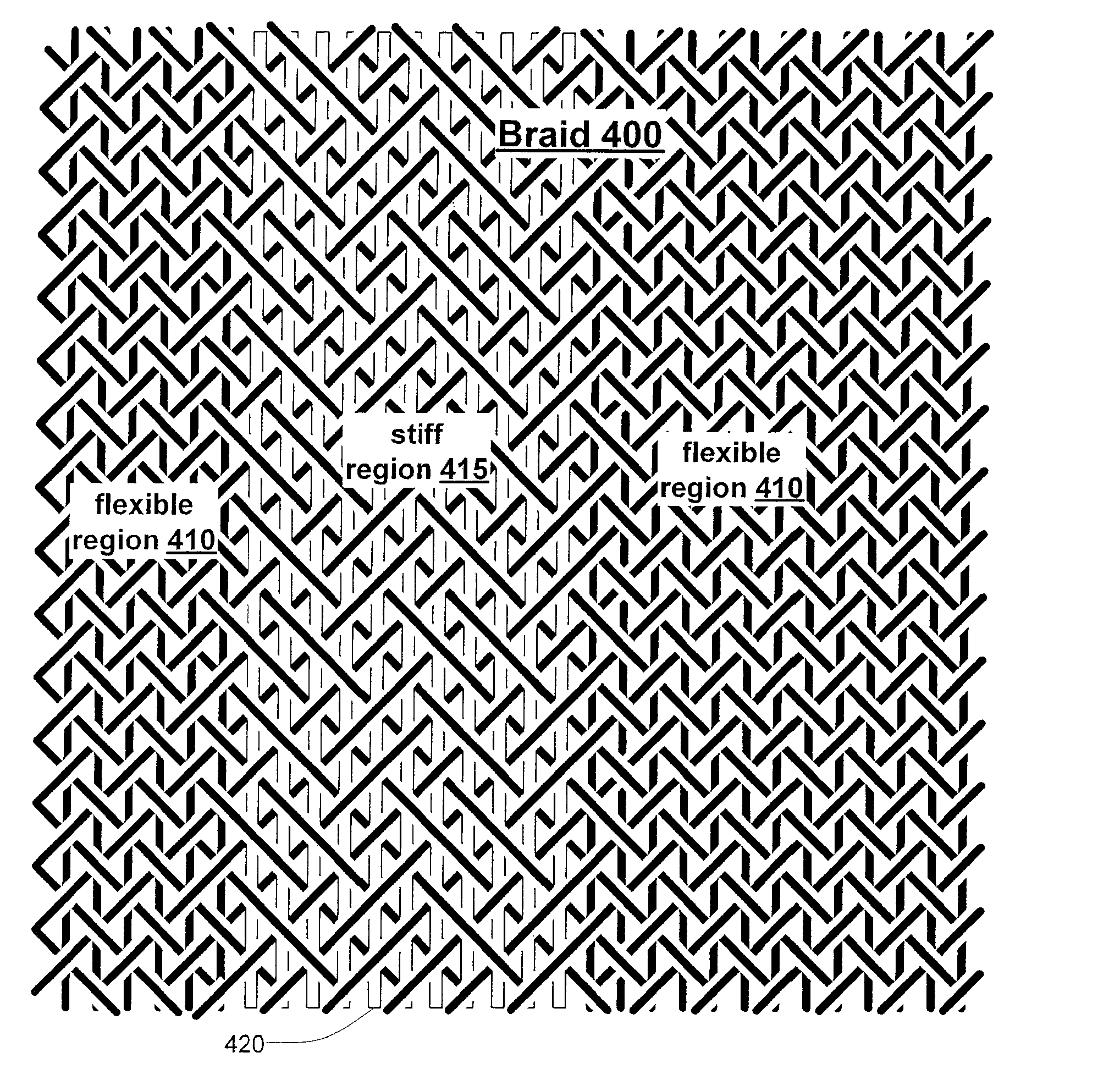 Inflatable structure with braided layer