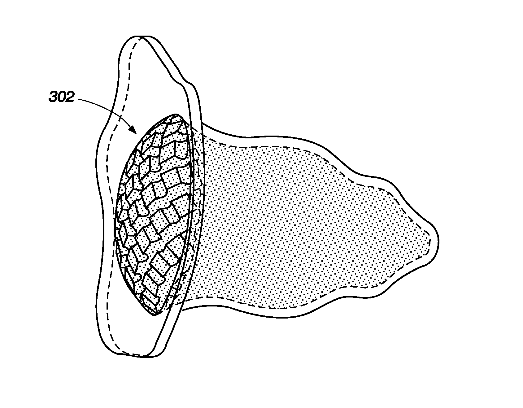 Medical device for modification of left atrial appendage and related systems and methods