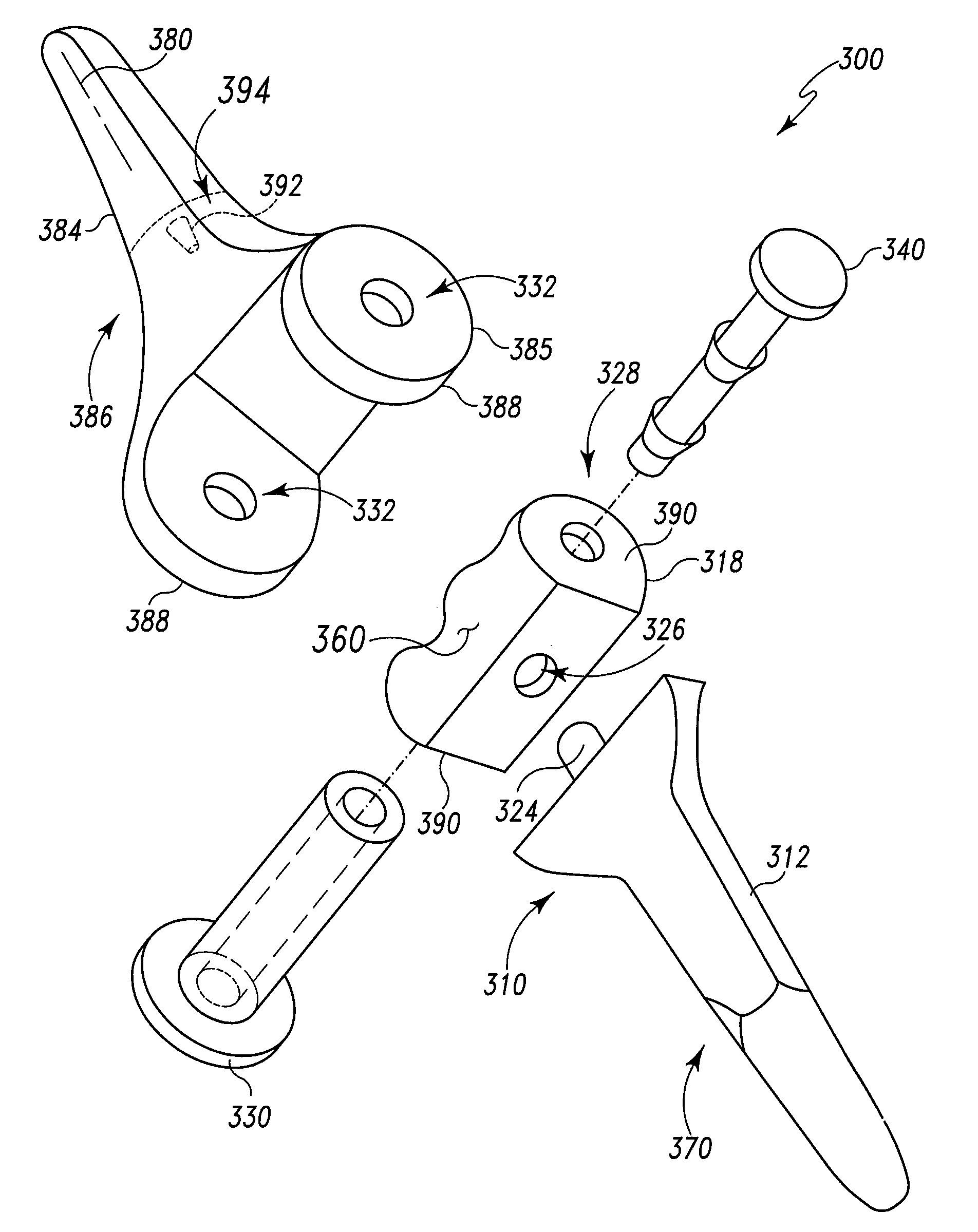 Modular total elbow prosthesis, humeral component and associated kit