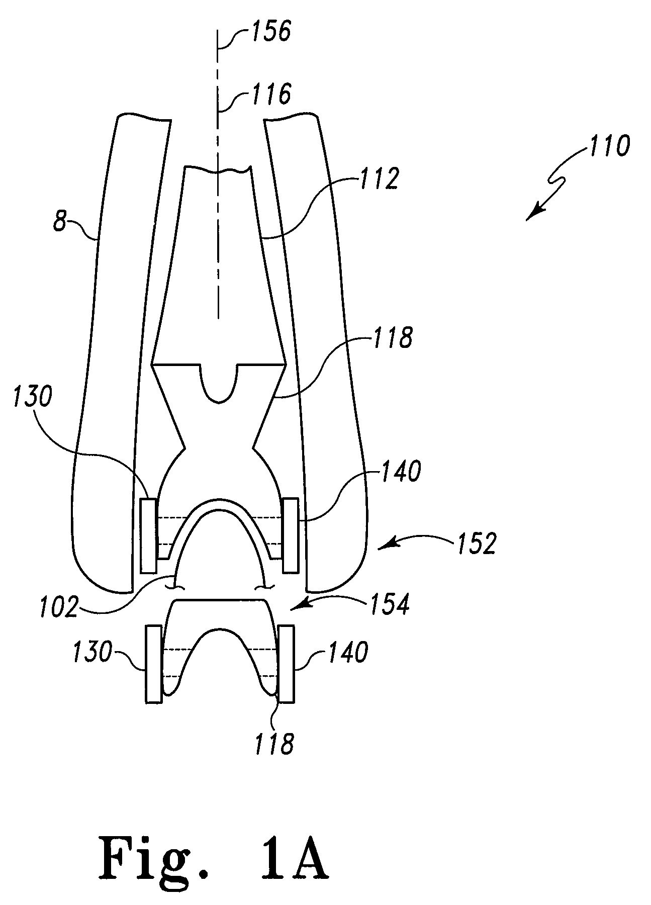 Modular total elbow prosthesis, humeral component and associated kit