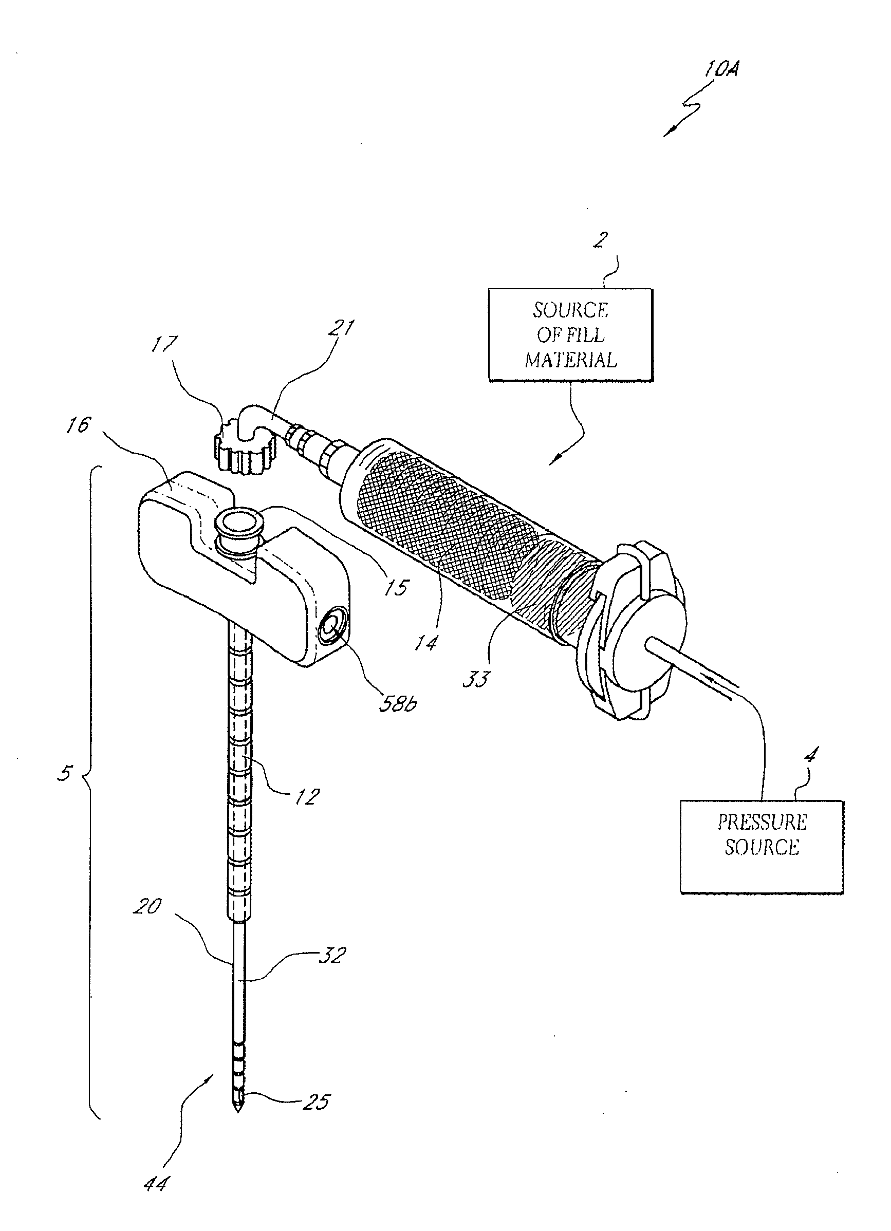 Bone treatment systems and methods