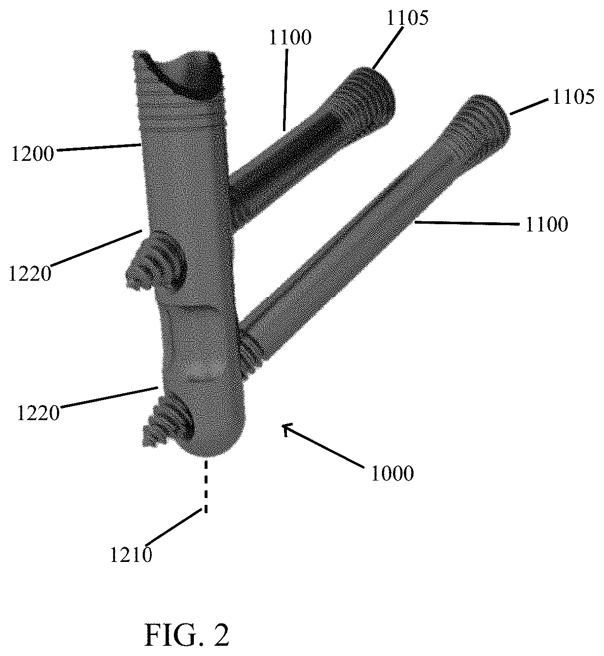 Bone defect repair apparatus and method