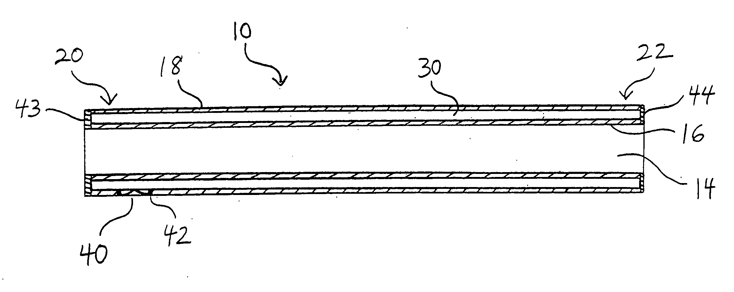 Inflatable biliary stent