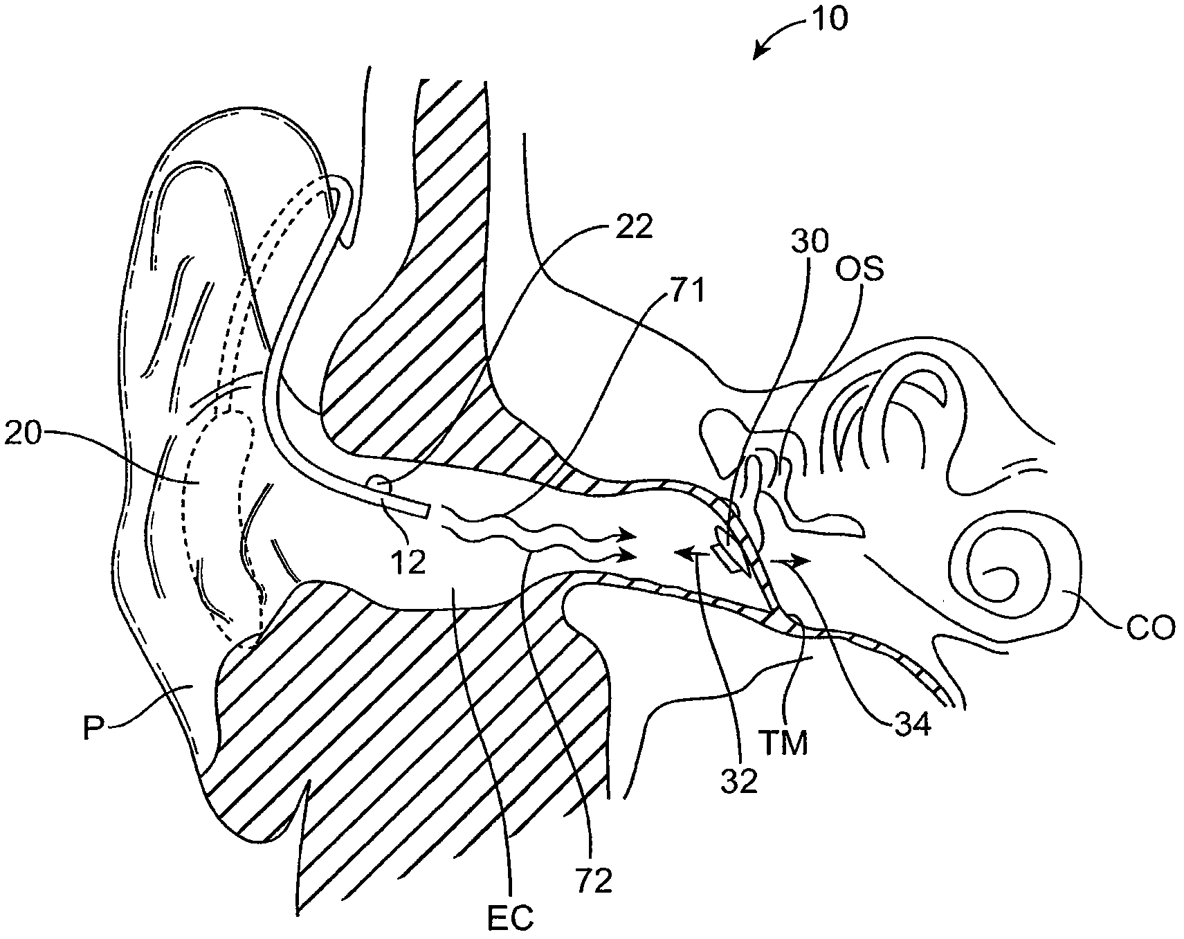 Optical electro-mechanical hearing devices with combined power and signal architectures