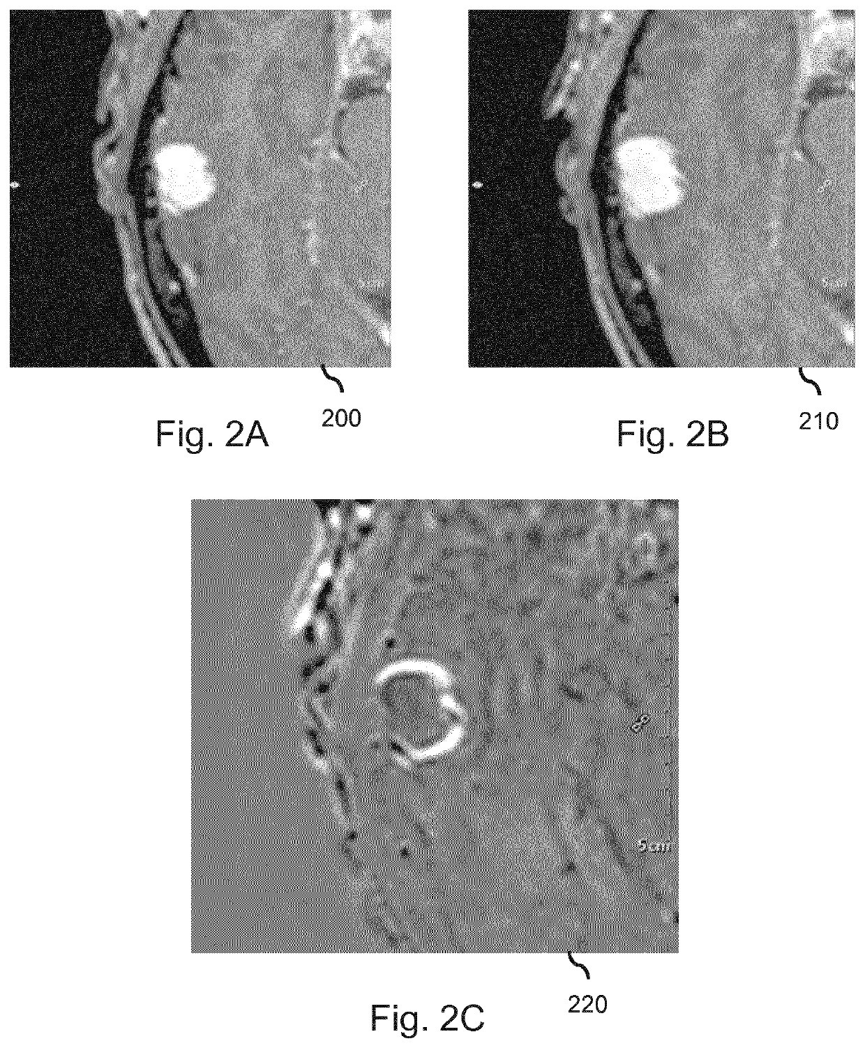 Change detection in medical images