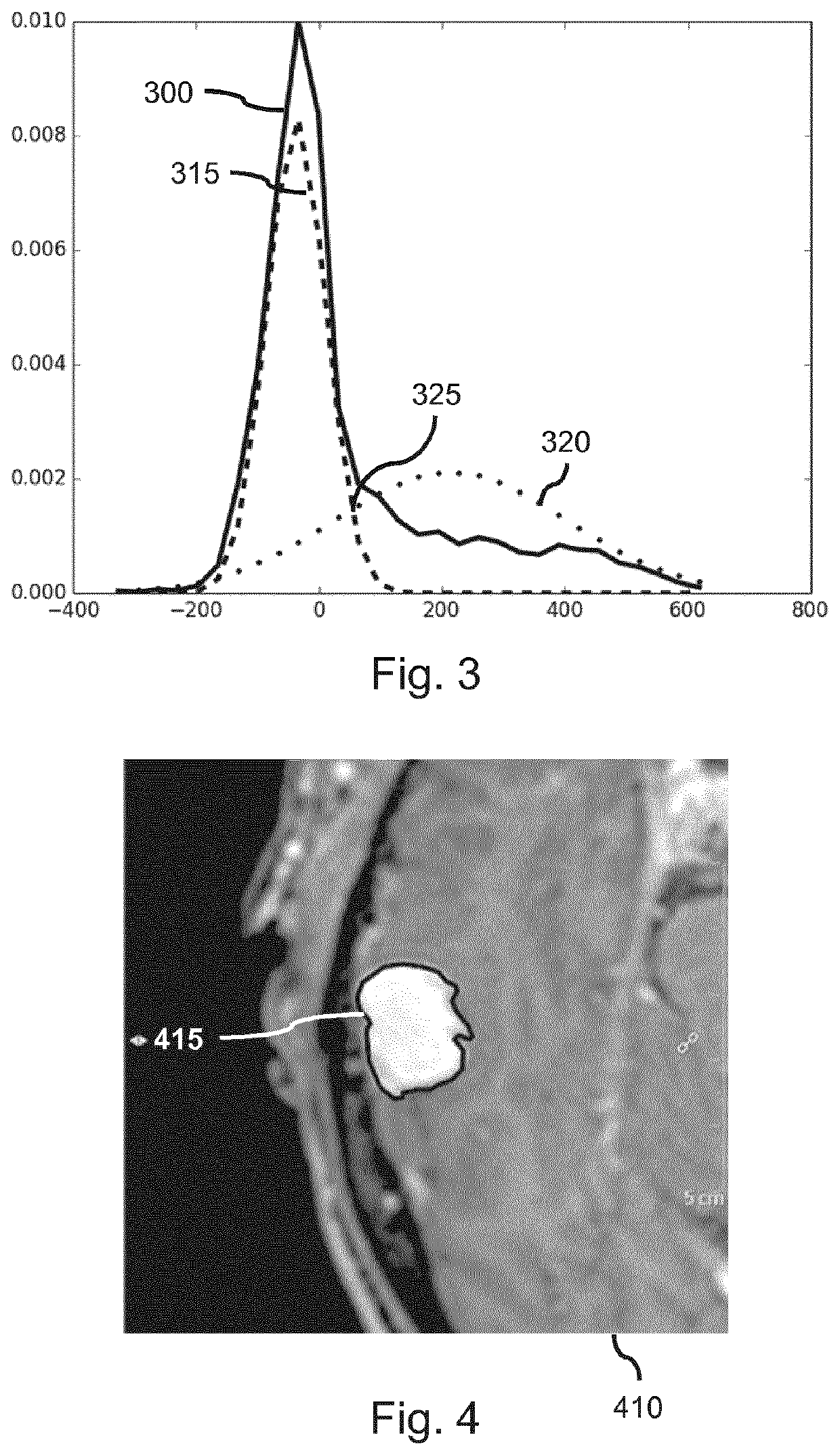 Change detection in medical images