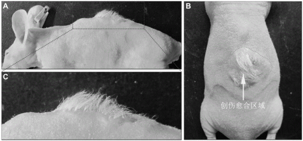 A skin reconstruction method based on hair follicle stem cells and silicone gel dressing