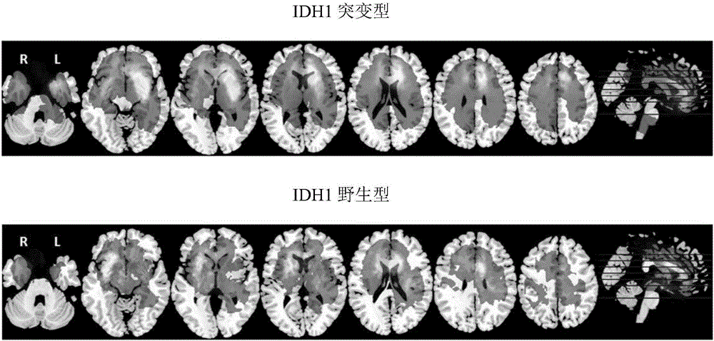 Brain glioma molecular marker nondestructive prediction method and prediction system based on radiomics