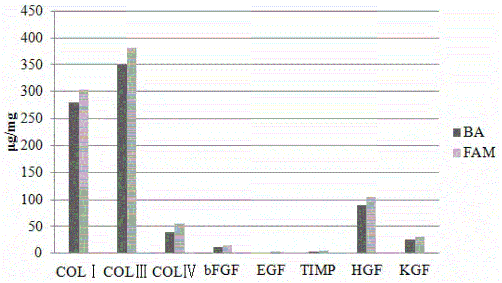 Biological membrane for treating glaucoma and preparation method thereof