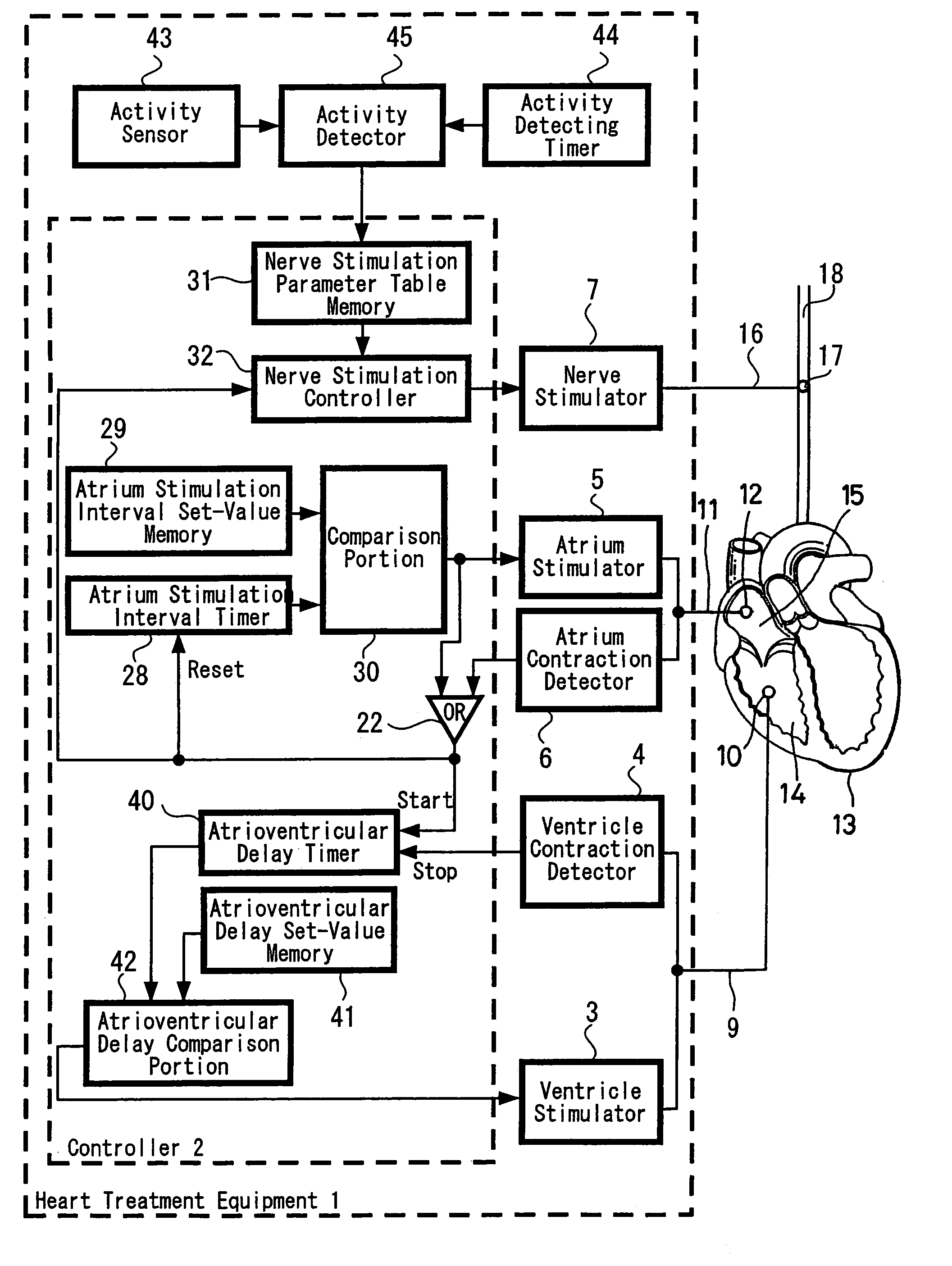 Heart treatment equipment and method for preventing fatal arrhythmia