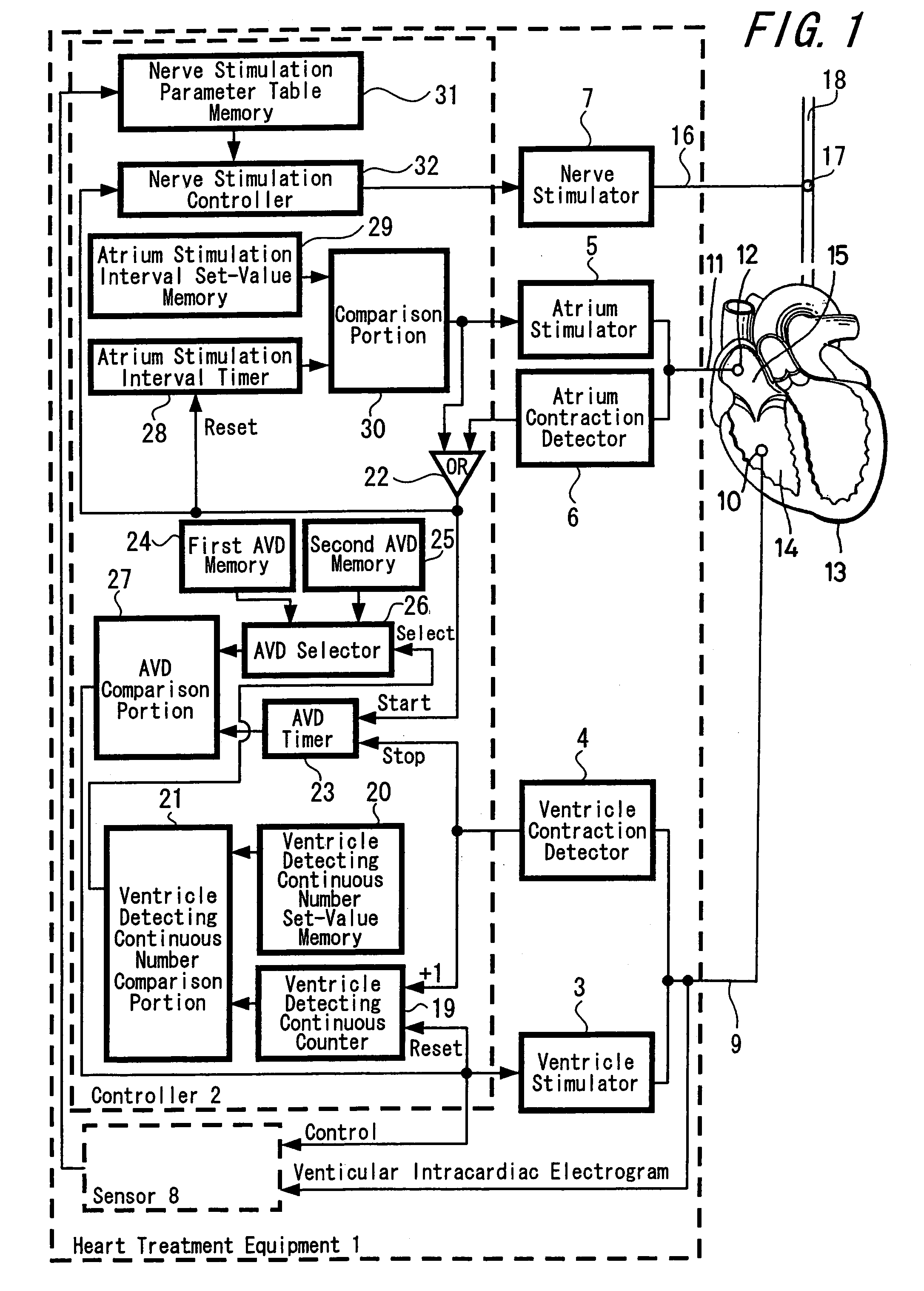 Heart treatment equipment and method for preventing fatal arrhythmia