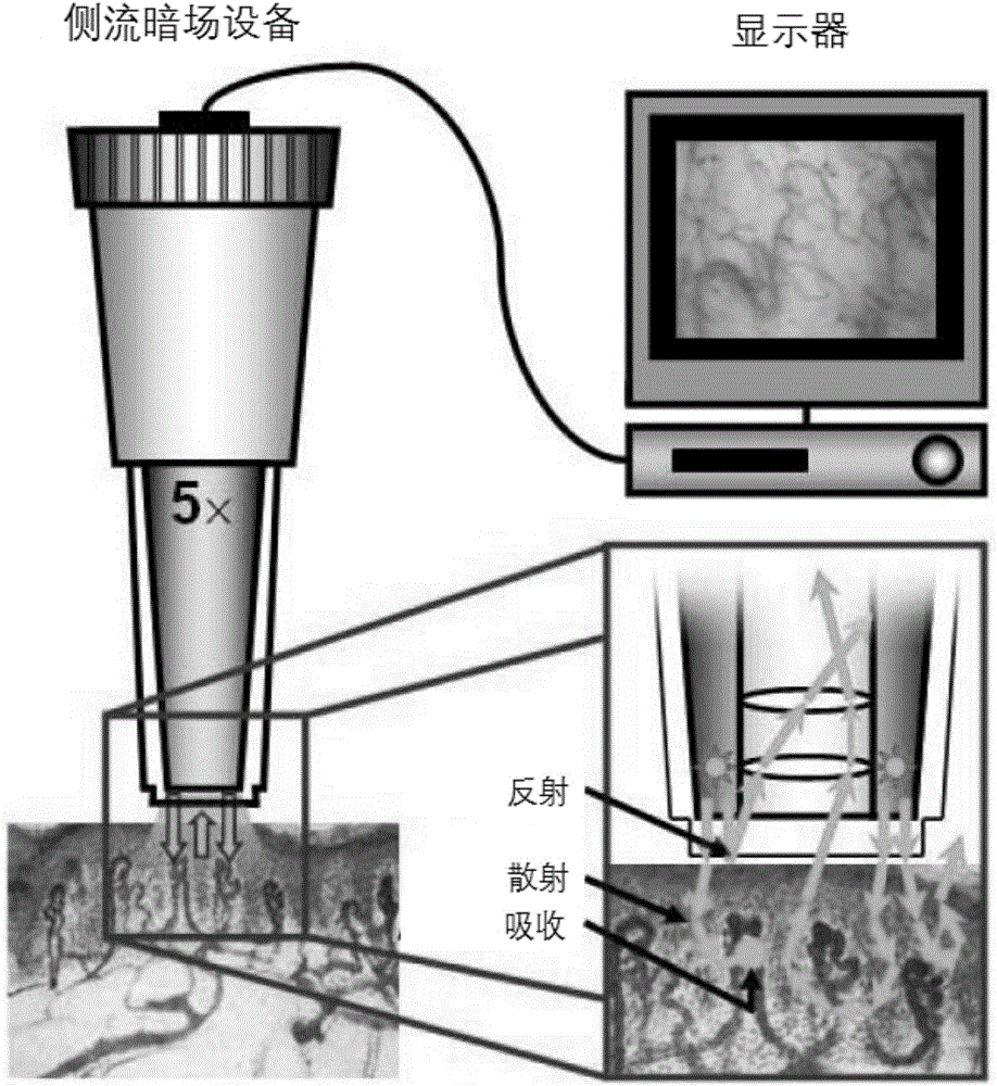 Sidestream dark field imaging technique-based human body microvessel three-dimensional ultrastructure imaging system