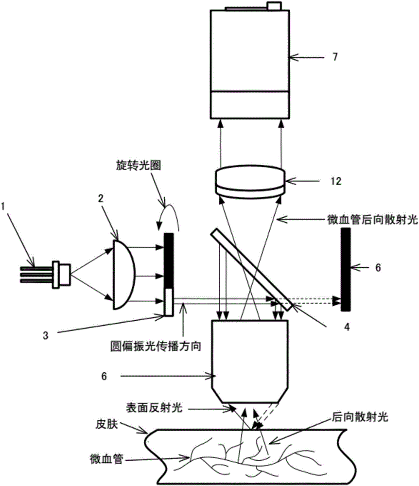 Sidestream dark field imaging technique-based human body microvessel three-dimensional ultrastructure imaging system