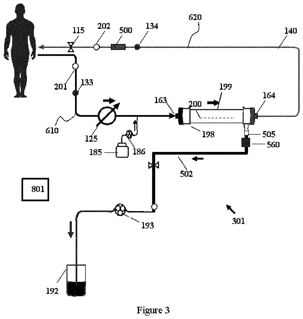 Modular hemodialysis system