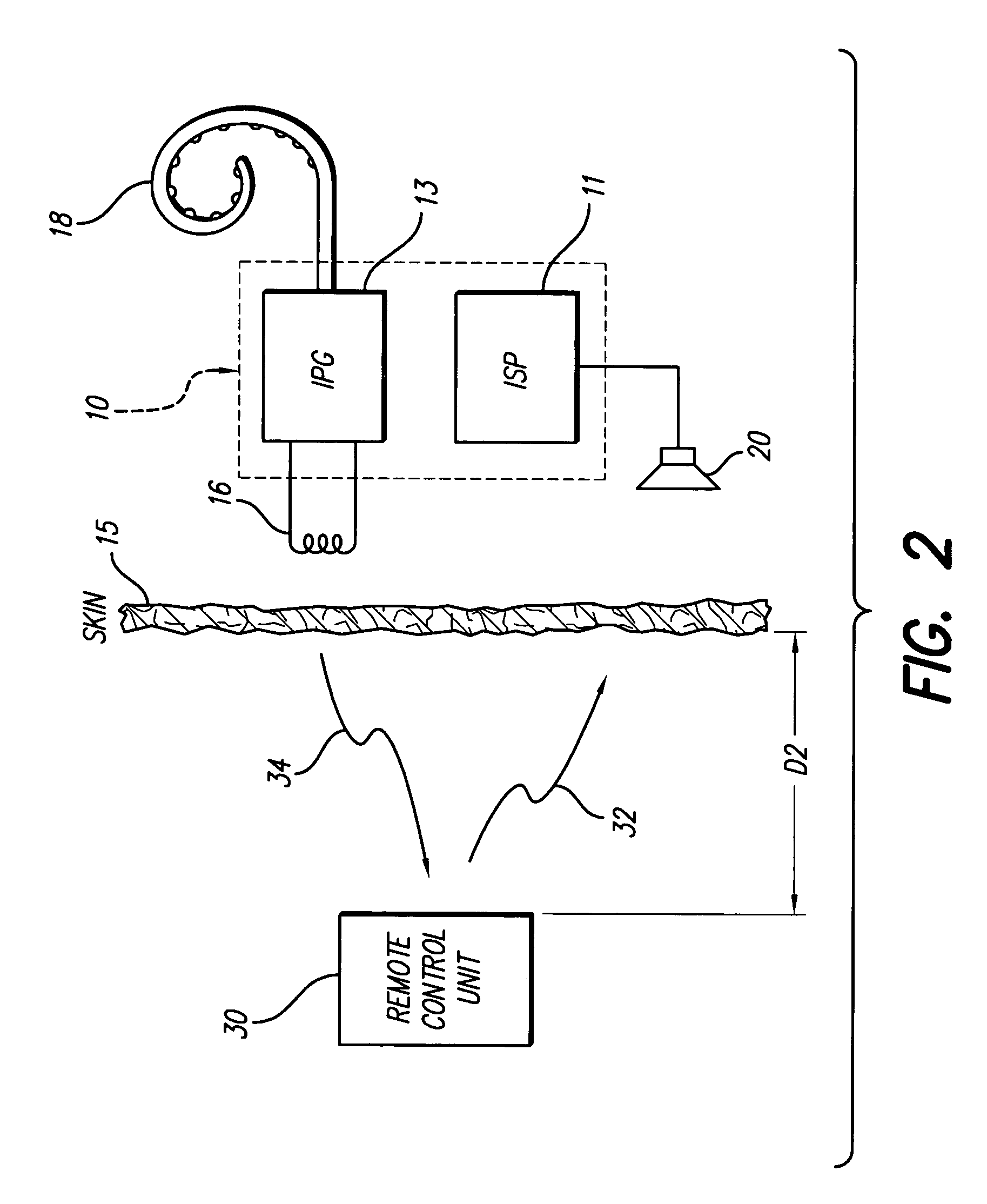 Remote control unit for use with an implantable neural stimulator system