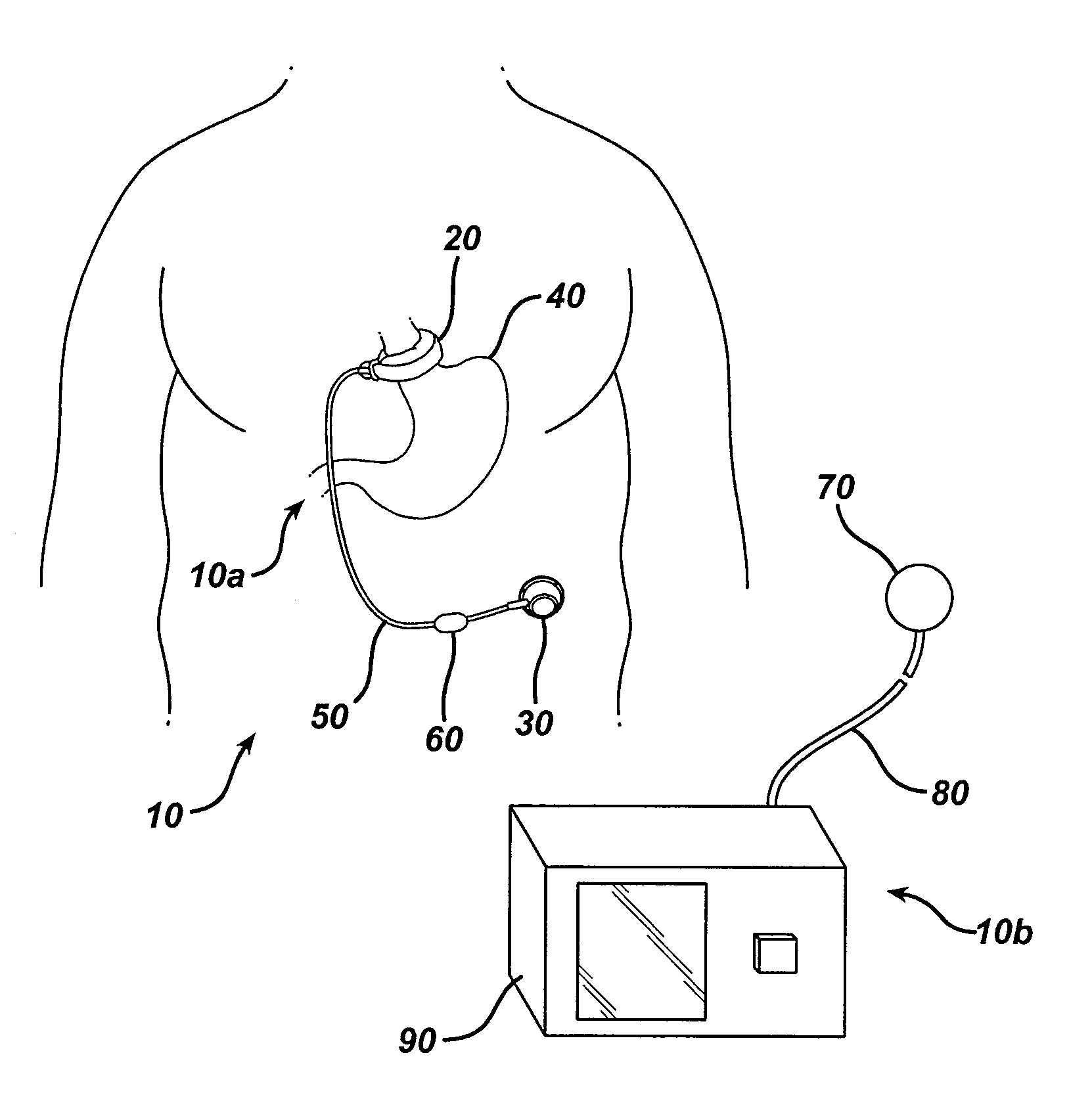 Automatically adjusting band system