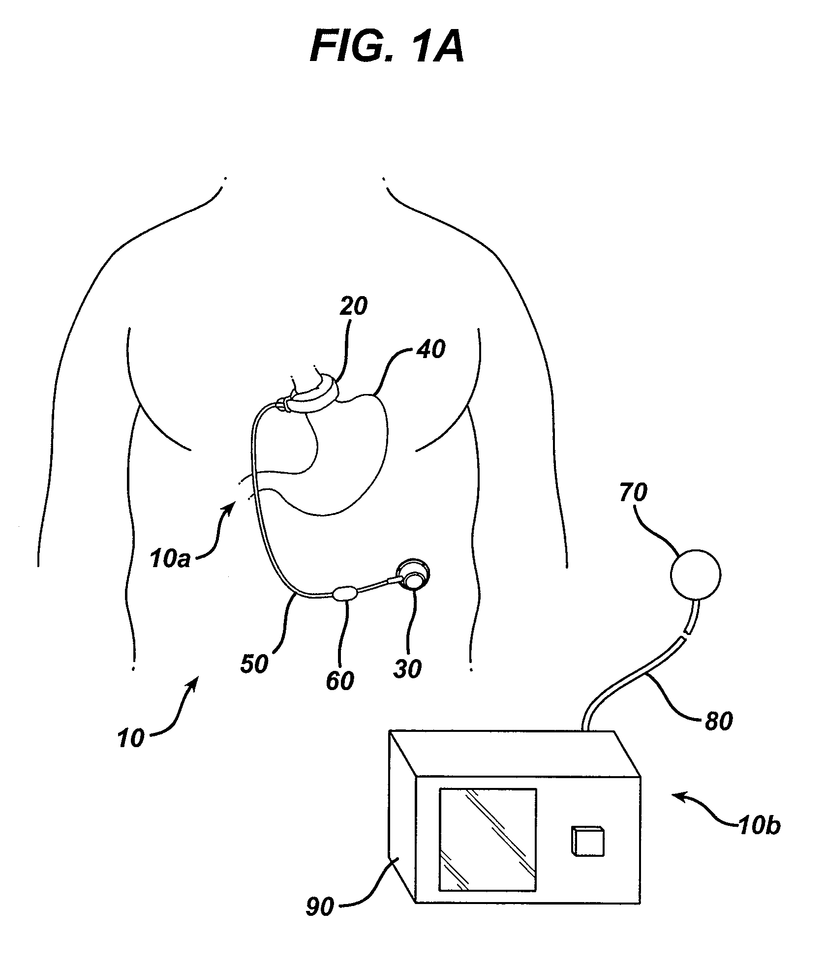 Automatically adjusting band system