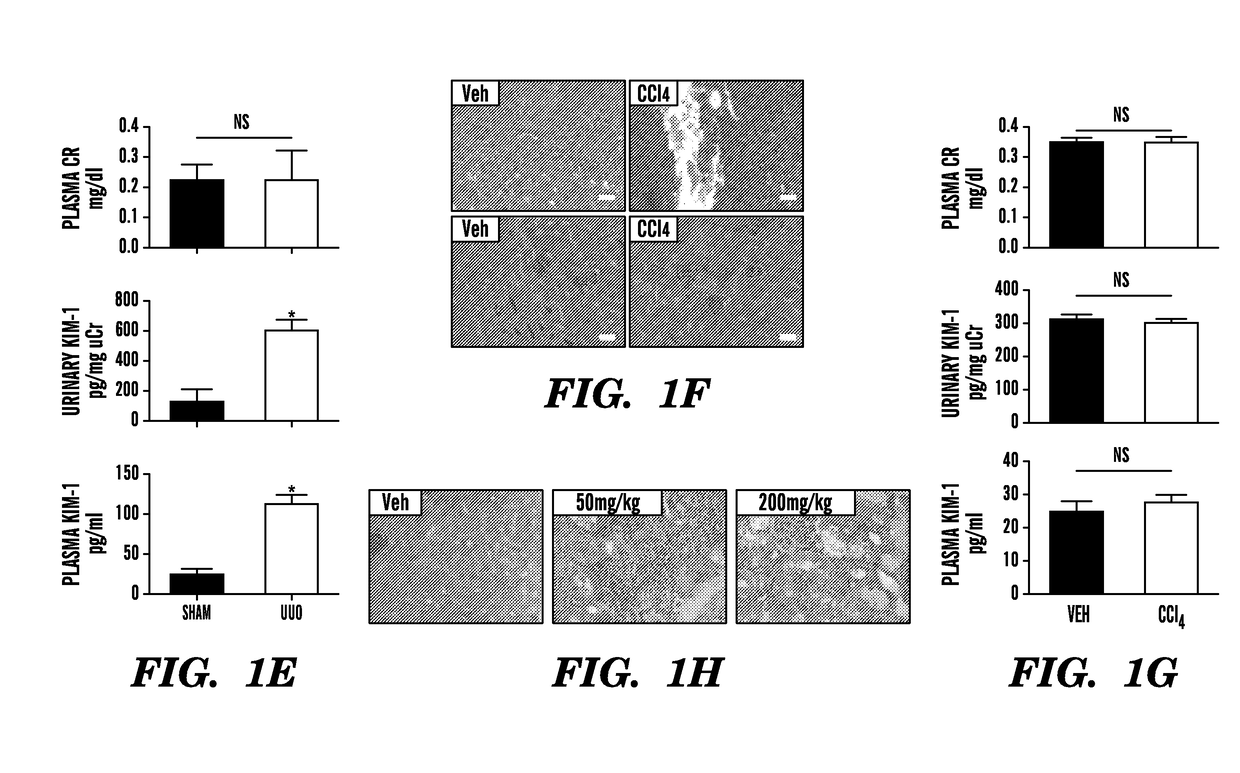 Circulating kim-1 levels for detection of pathologies associated with injury to, or cancer of, the kidney