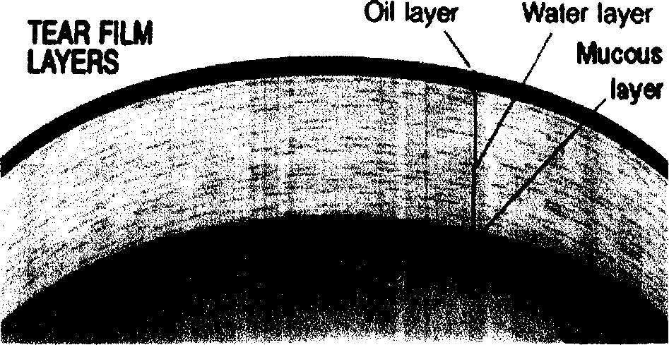 Eye formulation administering system containing lecithin and sodium hyaluronic acid and its preparing method