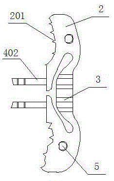 Stabilizer used between spine plates