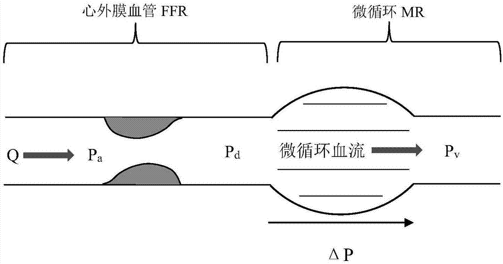 Method and system for quickly calculating microcirculation resistance