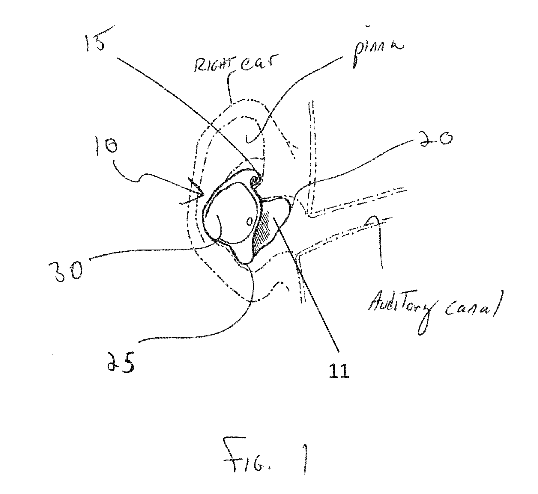 Sound system with ear device with improved fit and sound