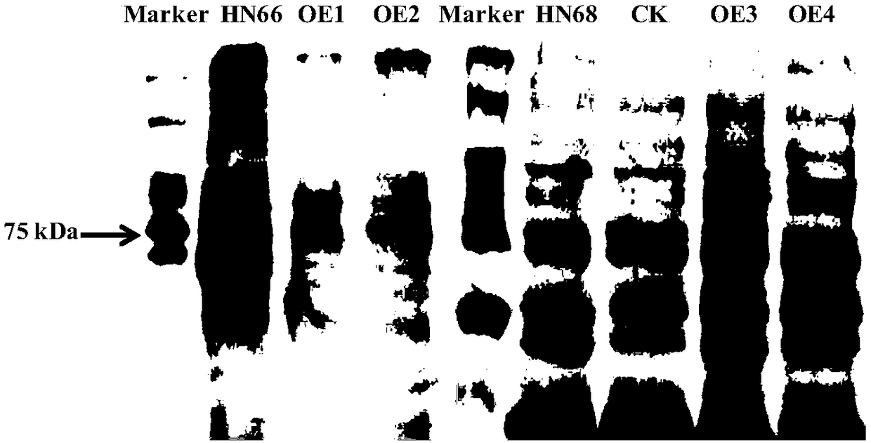 Application of purple acid phosphatase gene GmPAP35 of soybean