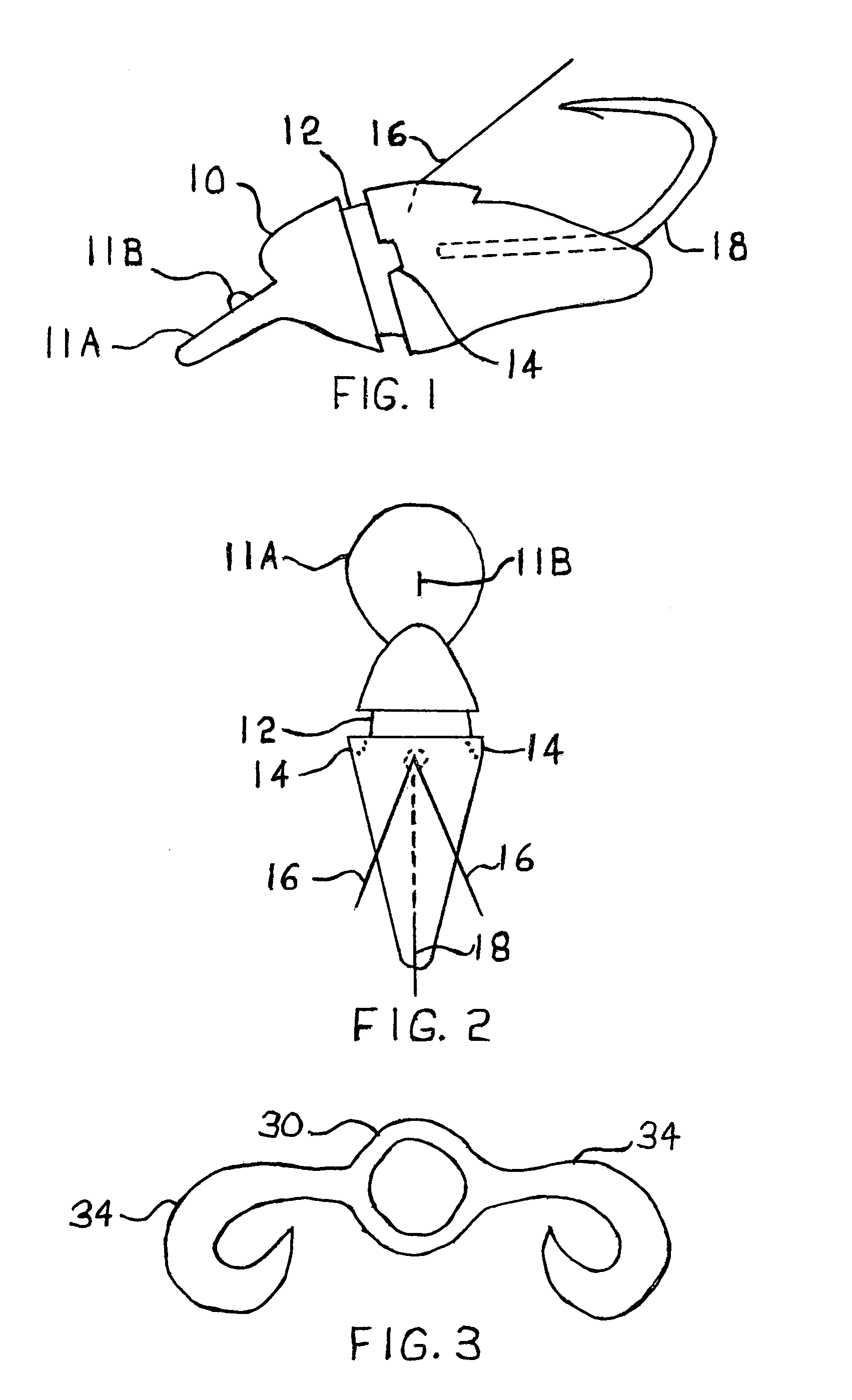 Snagless artificial fishing lure with pectoral appendages, and with a snag guard and top-mounted hook configuration