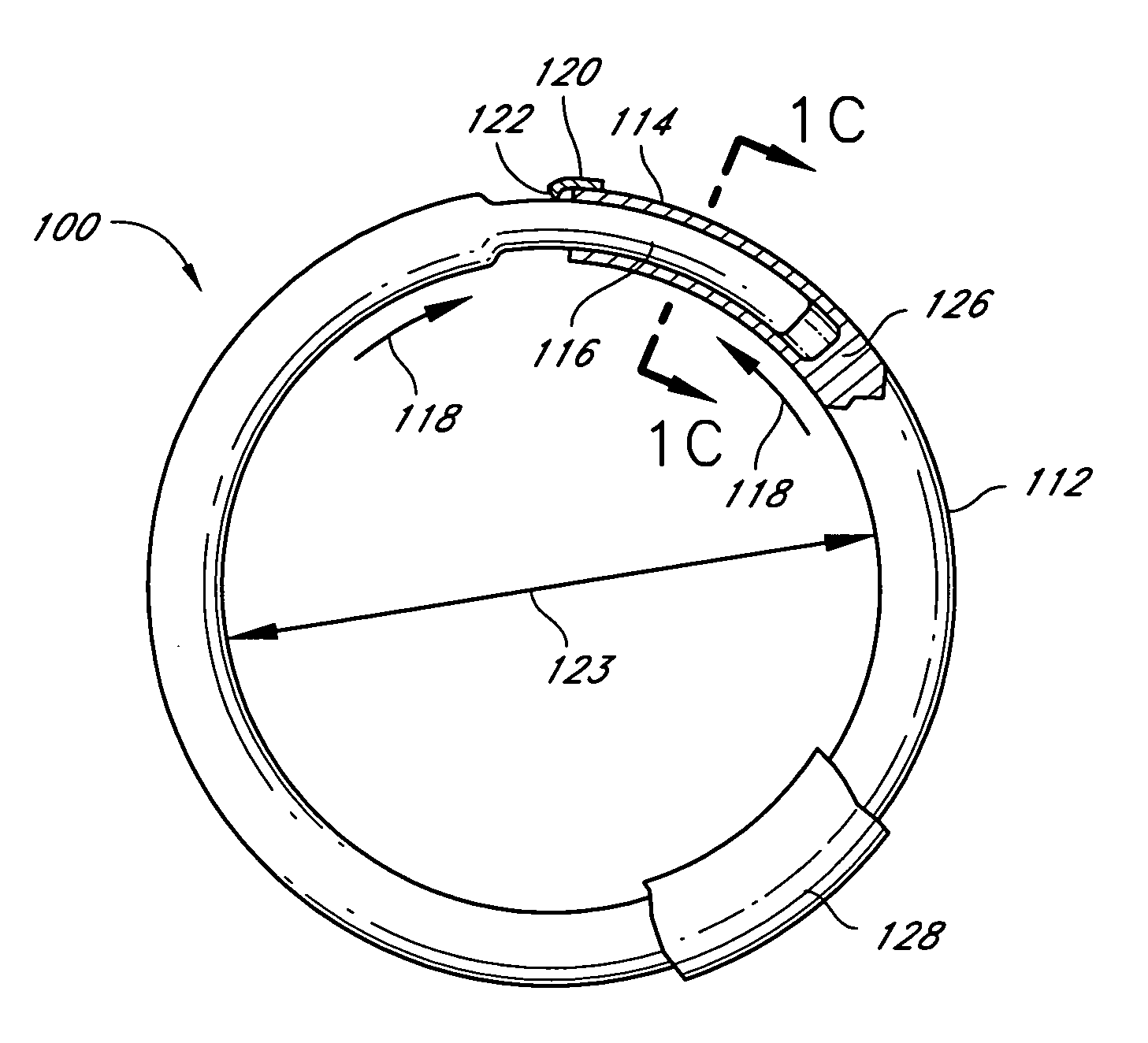 Methods for treating cardiac valves with adjustable implants