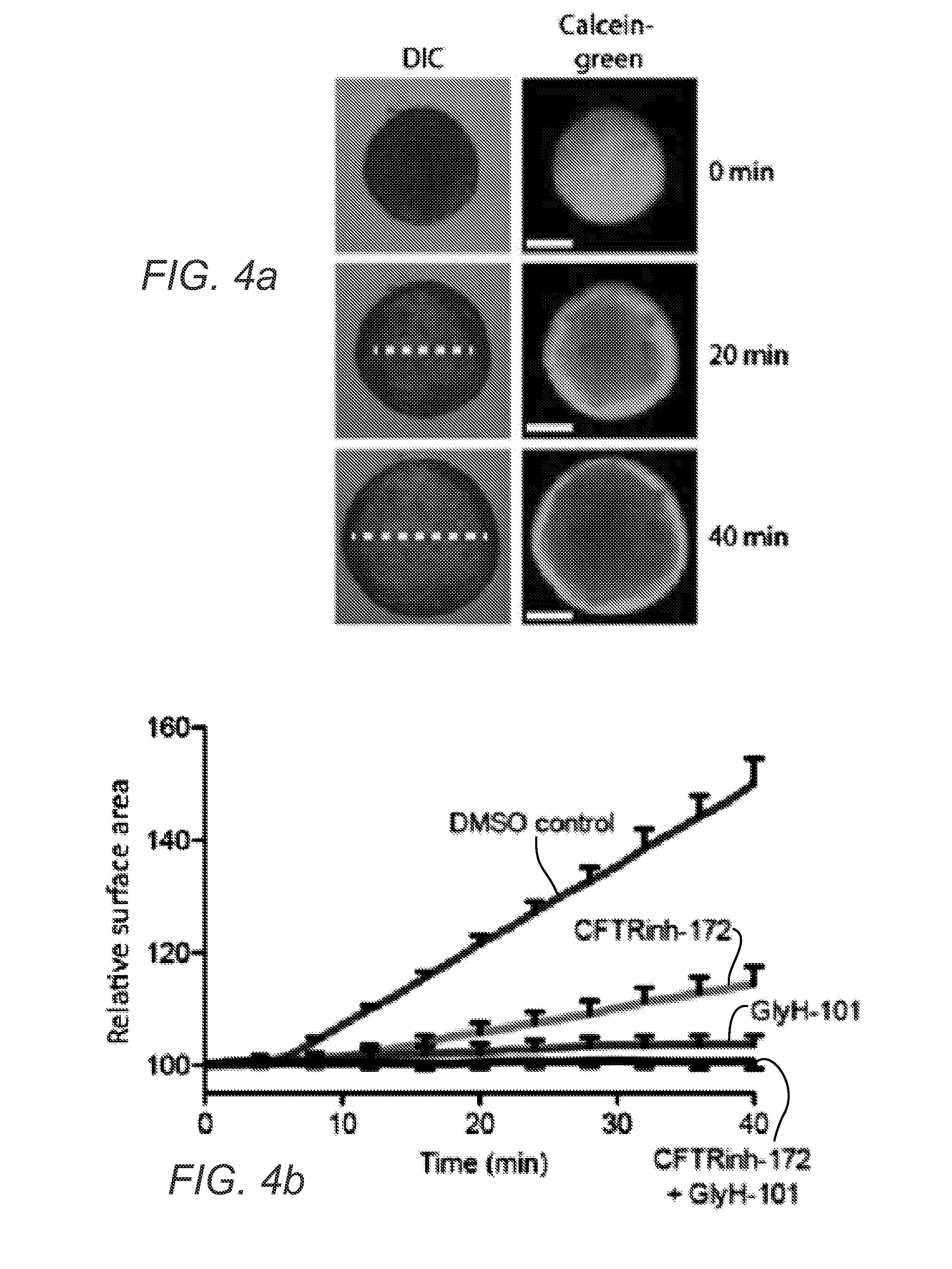 A rapid quantitative assay to measure cftr function in a primary intestinal culture model