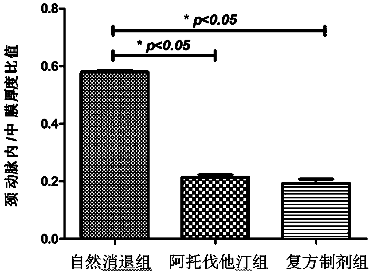A compound traditional Chinese medicine preparation for regressing and reversing atherosclerotic plaque and its preparation method