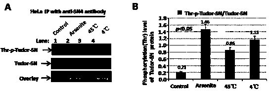 Preparation method of stress phosphorylation antibody aiming at human Tudor-SN protein T73 site