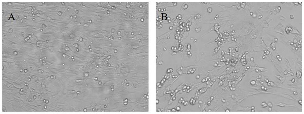 A kind of Seneca recombinant virus, recombinant vaccine strain and its preparation method and application of recombinant type A foot-and-mouth disease virus vp1 gene