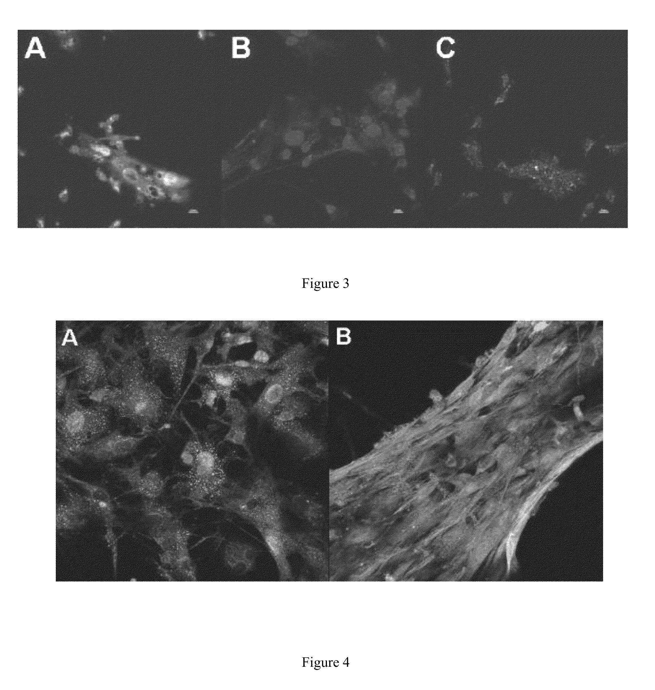 3-dimensional cardiac fibroblast derived extracellular matrix