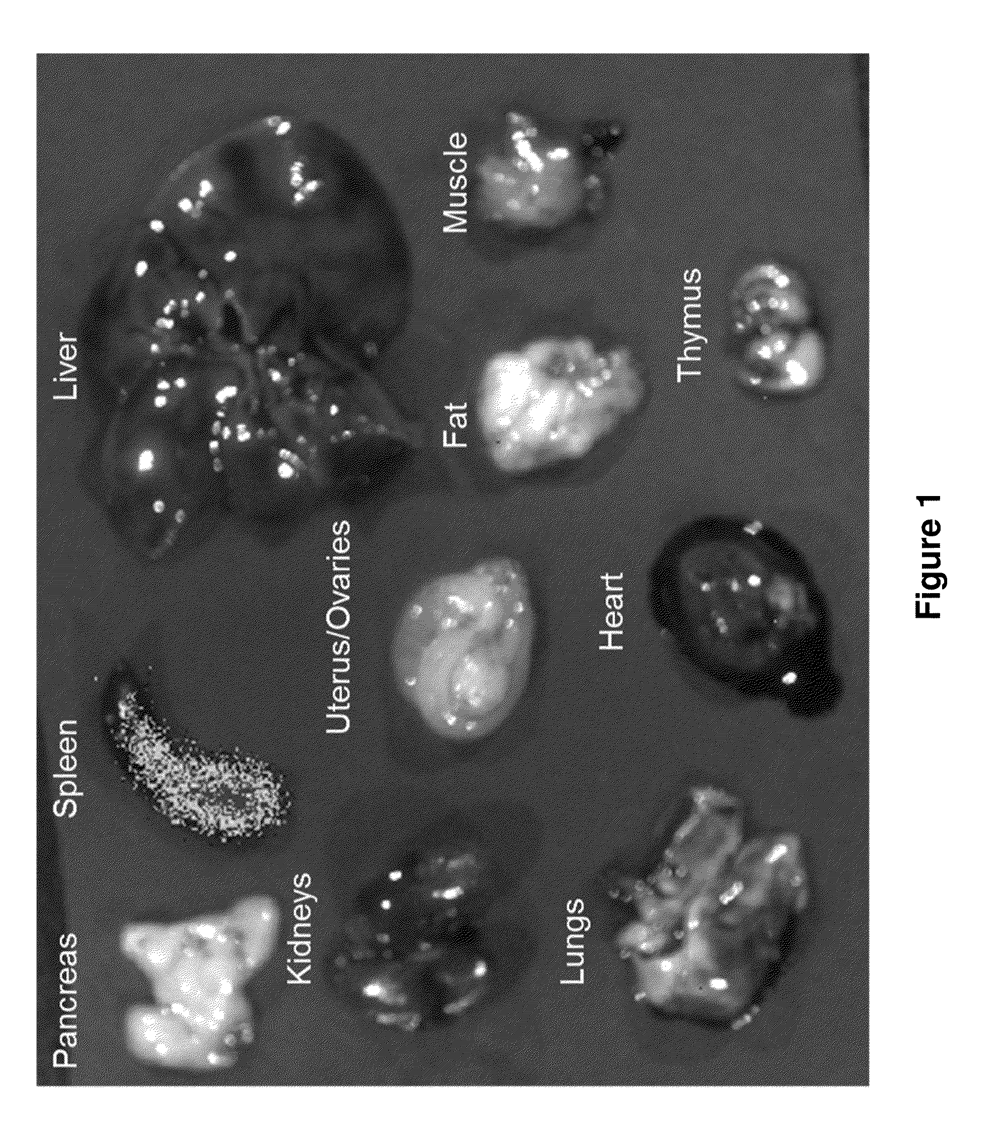 Polyamine-fatty acid derived lipidoids and uses thereof